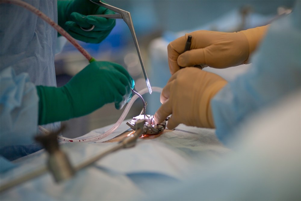 Операция по удалению межпозвонковой грыжи с последующей установкой имплантата проводится через минимальный разрез, с использованием тубусного ретрактора (ранорасширителя) и интраоперационного микроскопа.