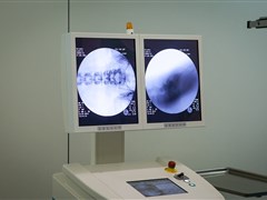 Процесс введения игл постоянно контролируется в двух проекциях при помощи интраоперационного рентгена.